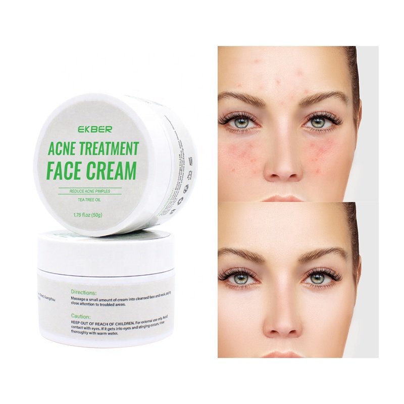 New Private Label Luxury Organic Anti Acne Face Cream Whitening Cream Plant Extract Anti-acne Organic Repair Face Cream