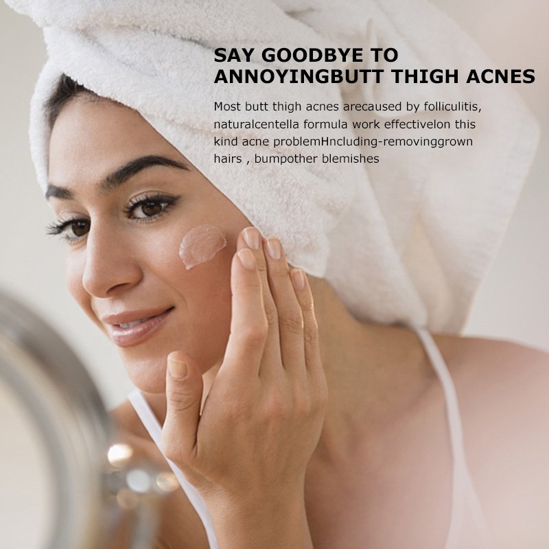 New Private Label Luxury Organic Anti Acne Face Cream Whitening Cream Plant Extract Anti-acne Organic Repair Face Cream