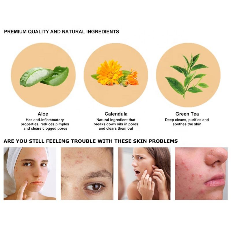 New Private Label Luxury Organic Anti Acne Face Cream Whitening Cream Plant Extract Anti-acne Organic Repair Face Cream