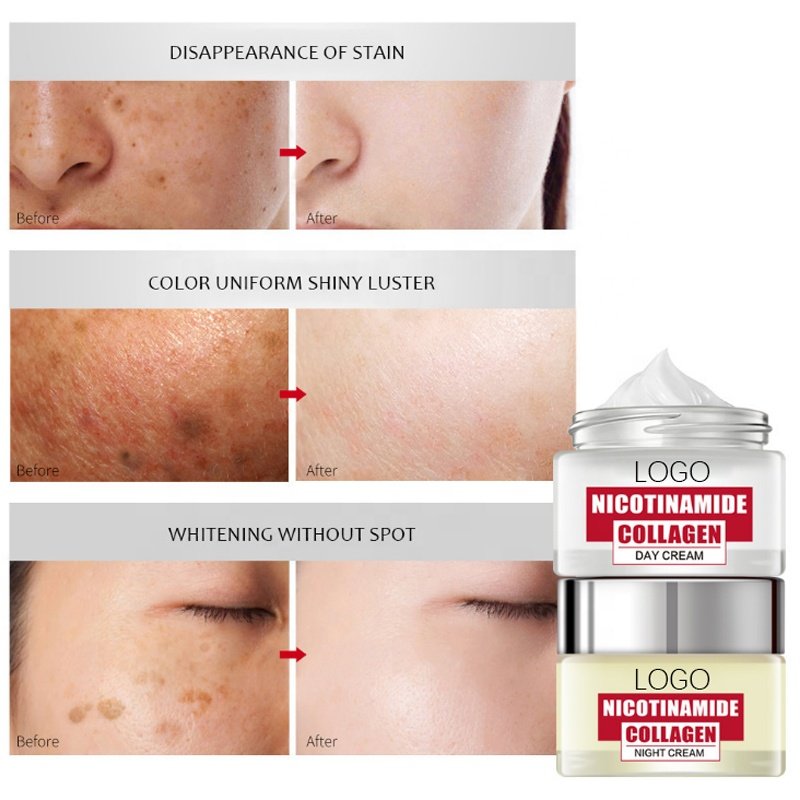 OEM 50g Anti Freckle Removal Dark Spot Day Night Nicotinamide Collagen Facial Cream Whitening Face Cream
