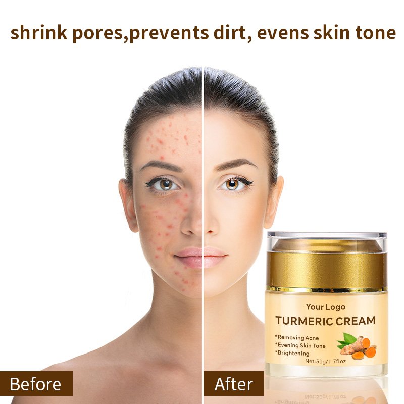 Private Label OEM Natural Organic Anti Aging Wrinkle Acne Whitening Bleaching Moisturizing Turmeric Face Cream