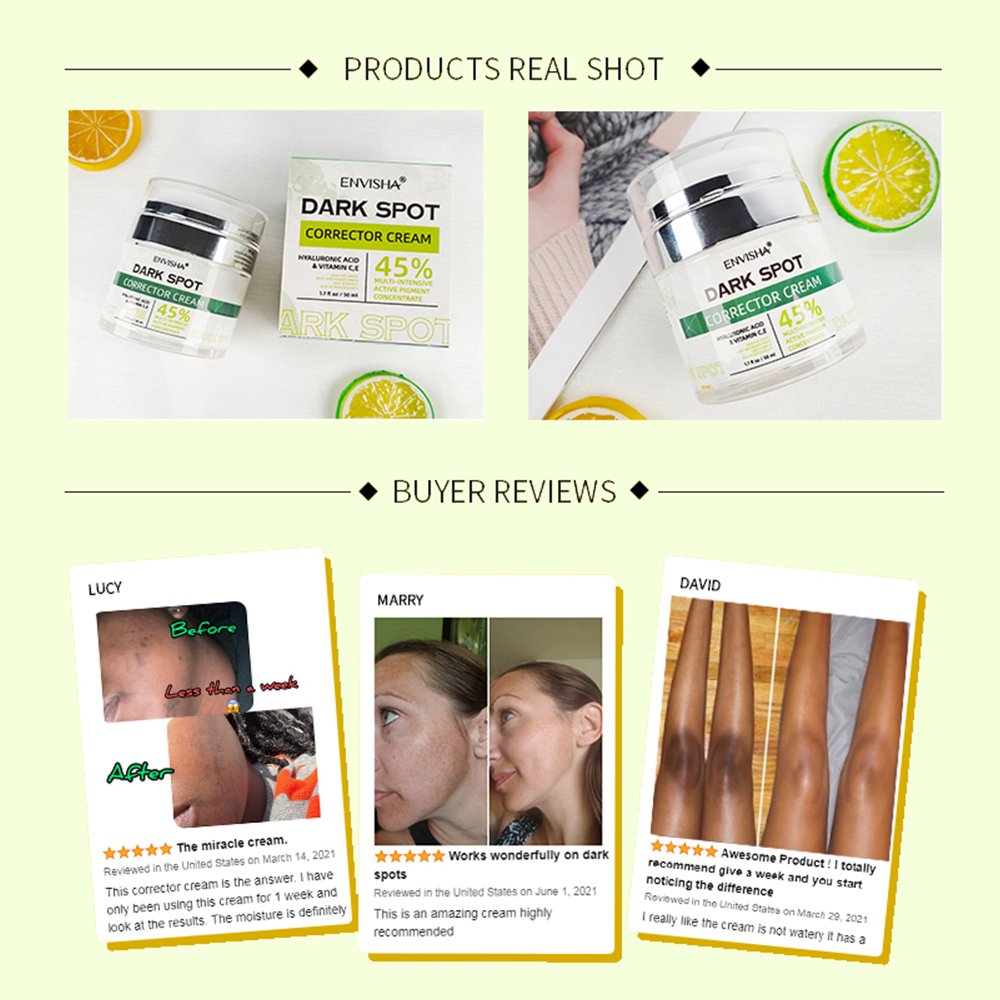 Pimples Melasma Blemish Removal Dark Spot Remover Cream Strong Bleaching Whitening Face Freckles Remove Corrector Cream