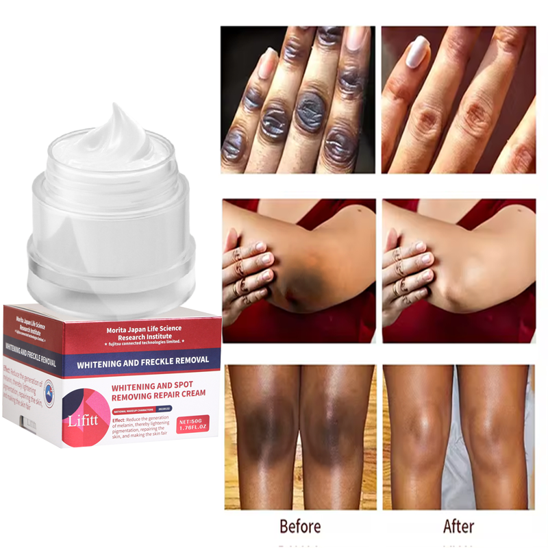 Face cream niacinamide dark spots remover deep nourishing natural beauty face skin care moisturizing cream