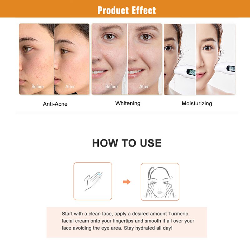 Private Label Organic Natural Anti-Aging Acne Treatment Facial Skin Pimple Turmeric Face Cream