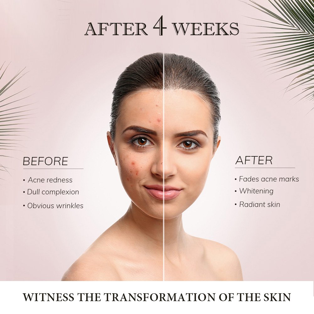 Hot Sale Organic Pimples Dark Spot Remove Cream Whitening Skin Lightening Cream Dark Spot Corrector Remover Face Cream