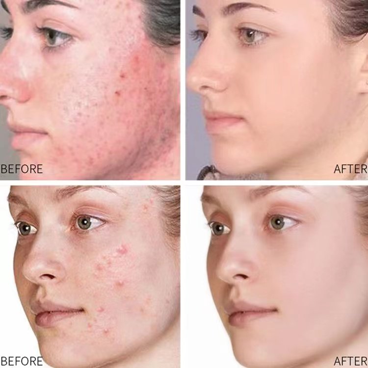 Private Label Sensitive Skin Calming Soothing Redness Relief Face Cream Moisturizer for Dry Skin