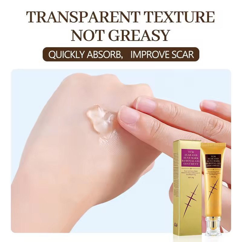 OEM ODM Custom Facial Cream Dark Spot Anti Acne Removal Ance Lightening Scar Removing Face Cream For Old Scars On Face Legs