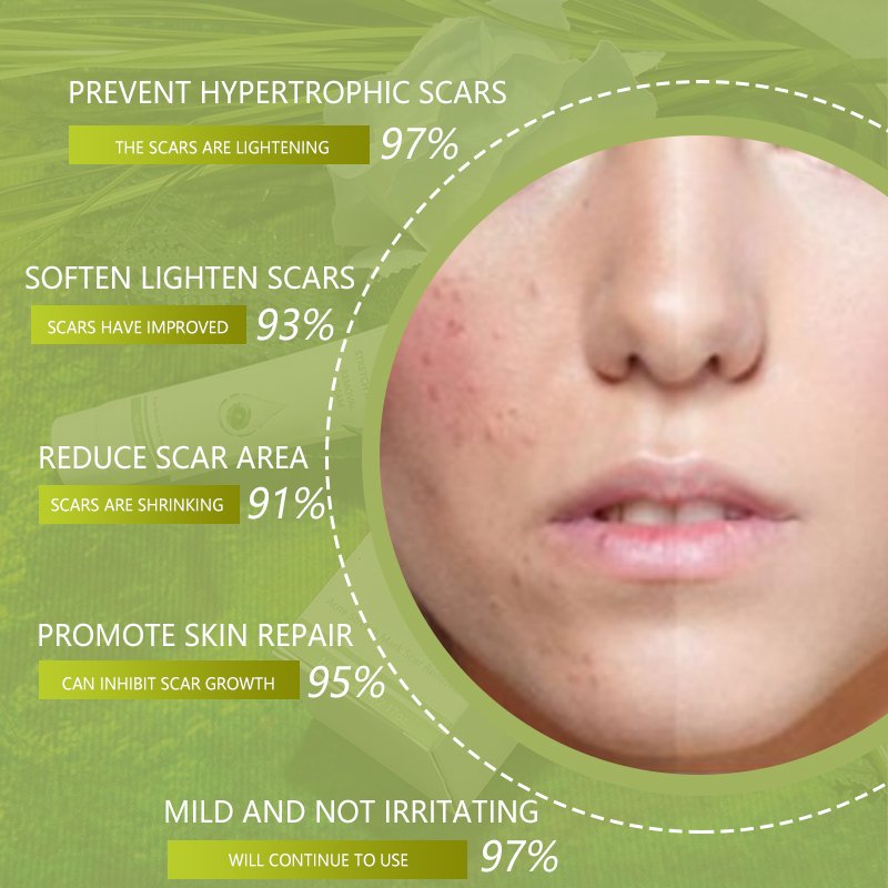powerful Acne Pimples Stretch Marks Scar Removing,Scar Removal Cream for Old Scars On Face And Legs,Body Scar Removal Cream