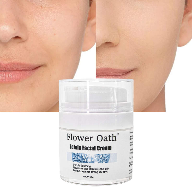 Flower Oath Sunburn and Authentic Cooling Face Cream from Philippines with Castor Oil 1kg Ectoin moisturizing face cream