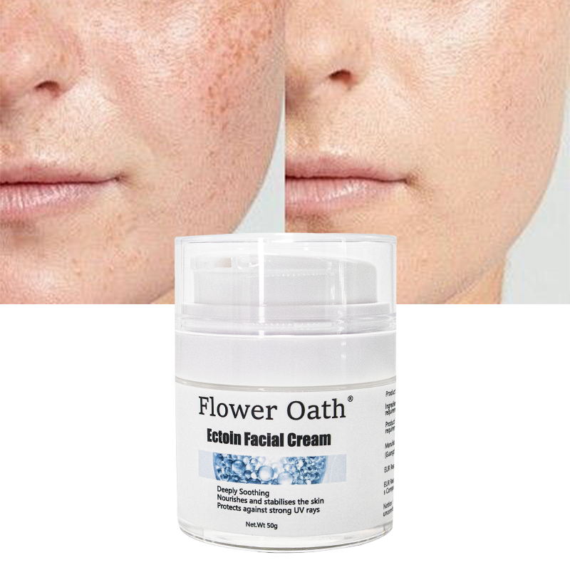 Flower Oath Sunburn and Authentic Cooling Face Cream from Philippines with Castor Oil 1kg Ectoin moisturizing face cream