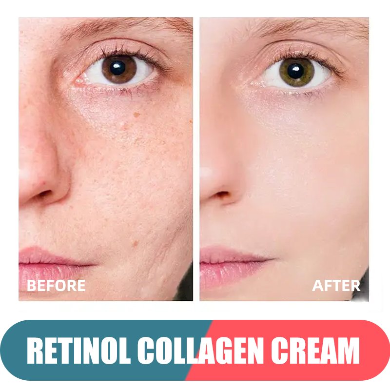 Custom Logo Skin Face Care Anti Aging Retinol Cream 50ml for women