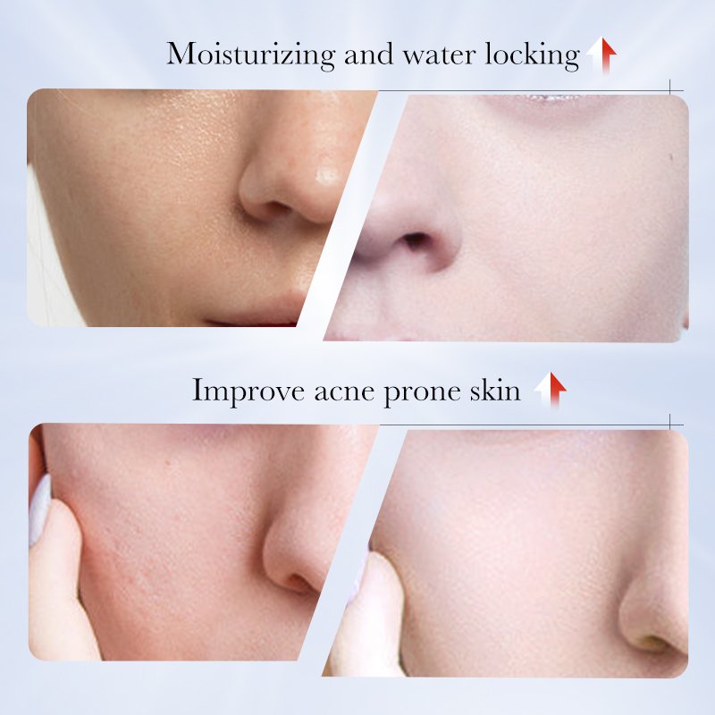SADOER Private Label Organic Kojic Acid Freckle Remover Skin Repair Lotion Moisturize Whitening Face Cream For Dark Black Skin
