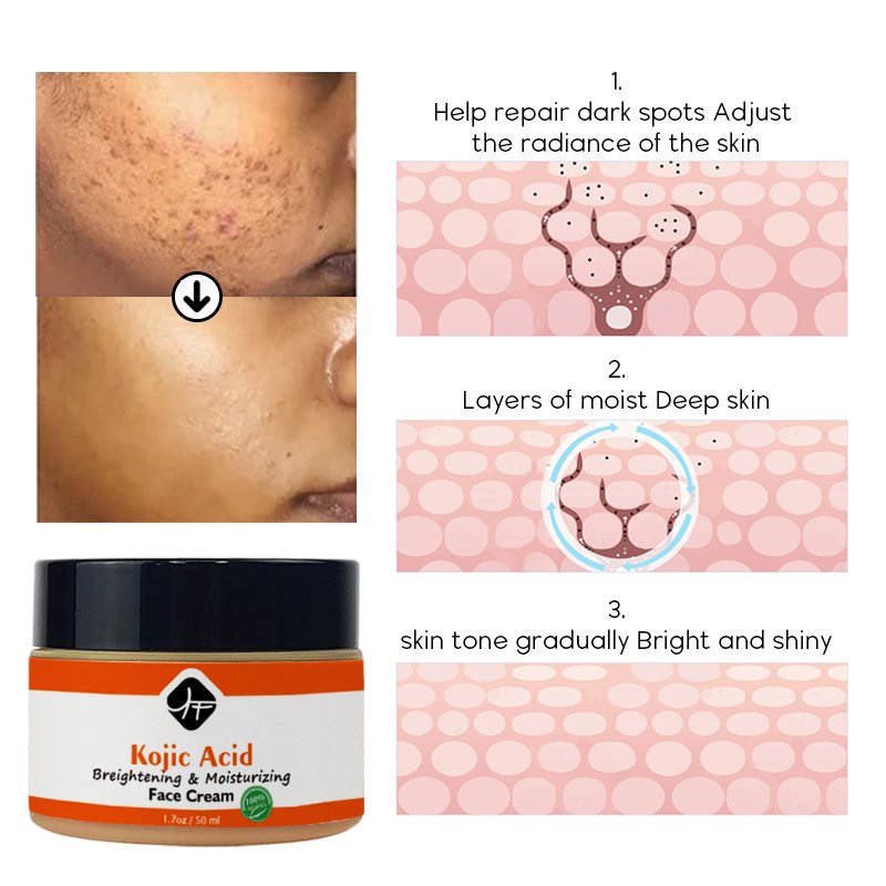 LOW MOQ Wholesale Hot Selling Natural Organic Spot banishing face serum &cream Whitening Moisturizer KOJIC ACID FACE serum Cream