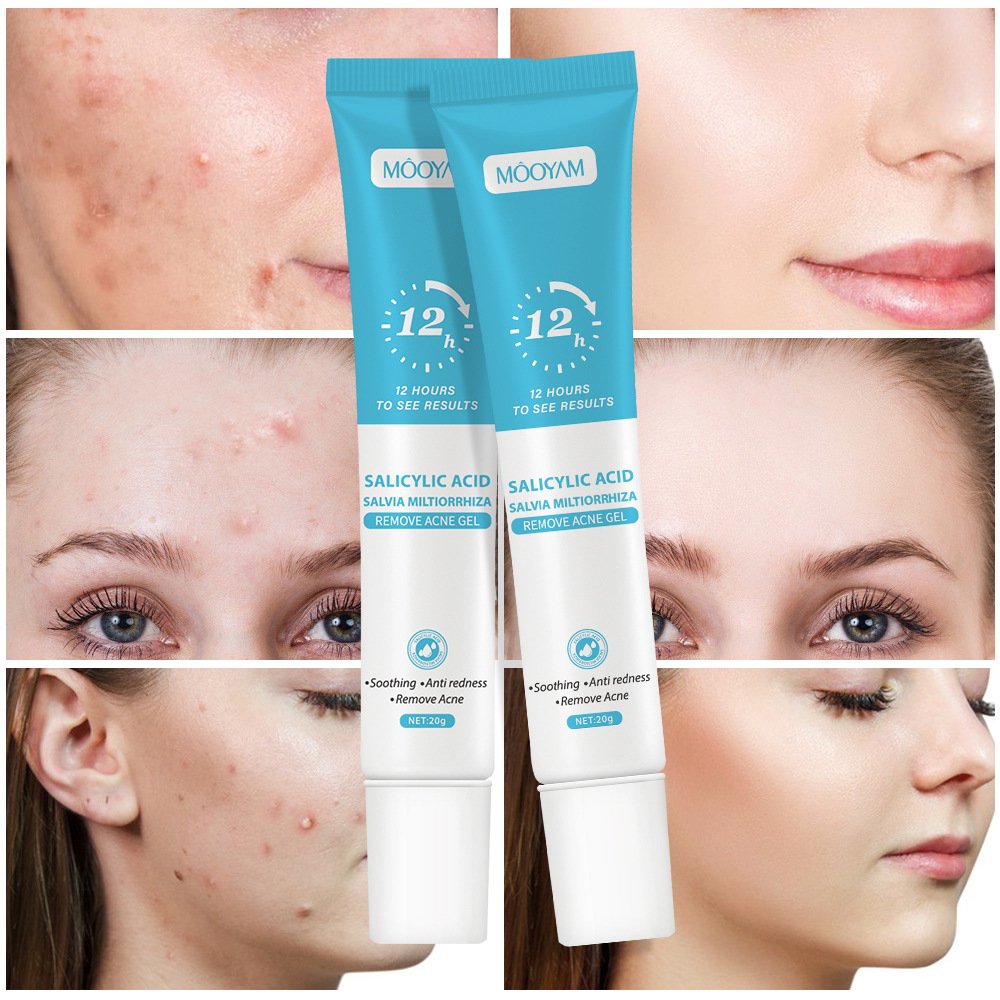 High Quality Fast Effective Repair Pimple Anti Spots Smooth Skin Shrink Pores Face Cream