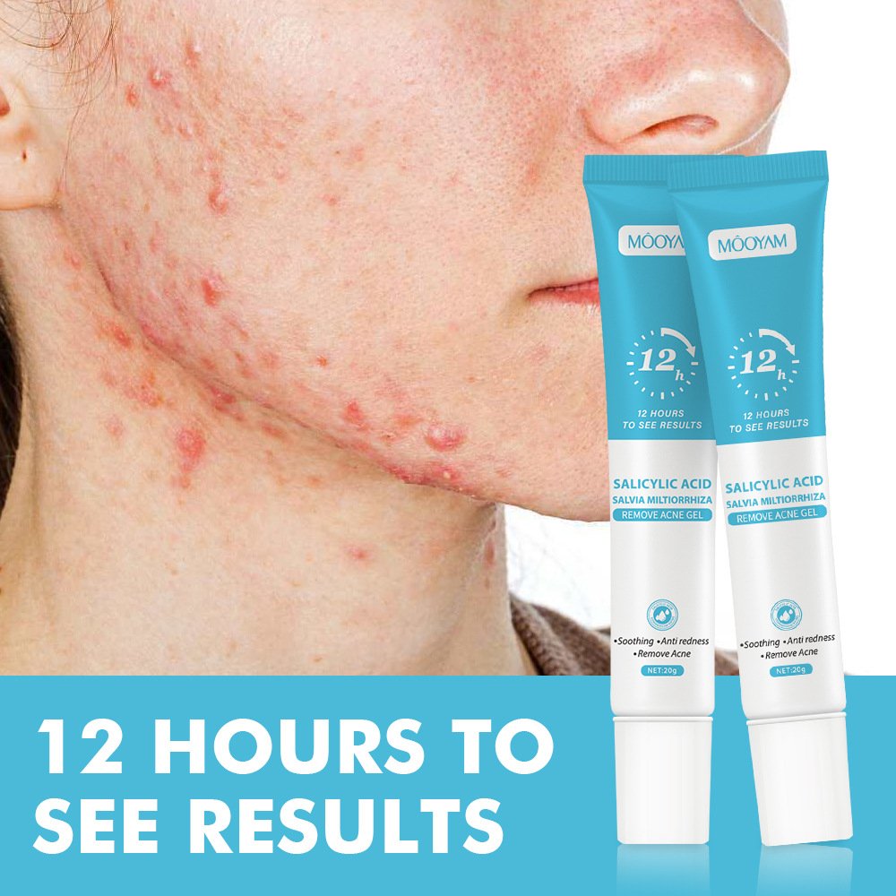 High Quality Fast Effective Repair Pimple Anti Spots Smooth Skin Shrink Pores Face Cream
