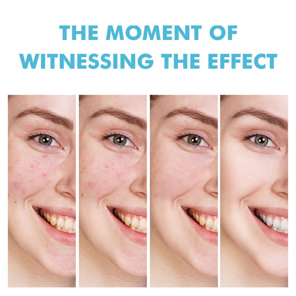 High Quality Fast Effective Repair Pimple Anti Spots Smooth Skin Shrink Pores Face Cream