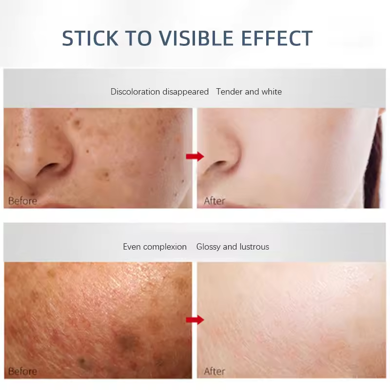 OEM Quality Wholesale Skin Care Face Cream Dark Spot Removing Cream Pigmentation Correctors Anti Wrinkle Facial Cream