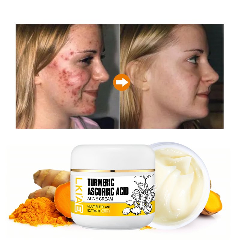 LKIAE Turmeric Creams Instant Lift Whitening Cleaner 35+ Beauty Organic Turmeric Anti Acne Cream Face For Sensitive Skin