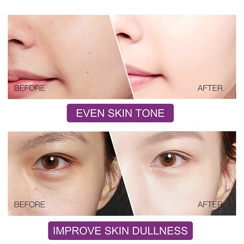 Best Facial Neck Lightening Care Vitamin C Moisturizer Bleaching Dark Spot Removing Skin Whitening Serum Face Cream