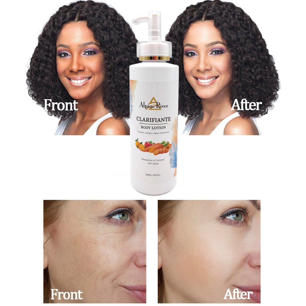 OEM Whitening Lotion Skin Lightening Dark Skin Bleaching Cream Body Whitening Lotion