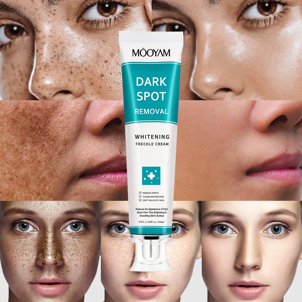 Wholesale Whitening Freckles Cream Remove Melasma Dark Spots Lighten Melanin Remover Moisturizing Brightening Face Skin Care