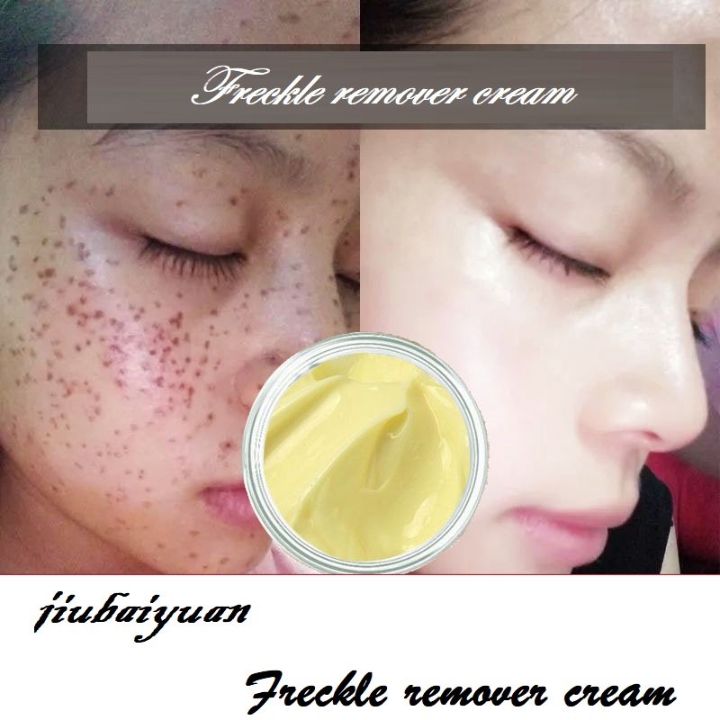 7-day quick spot removing cream semi-finished freckle removing face cream dark spot removing face whitening cream
