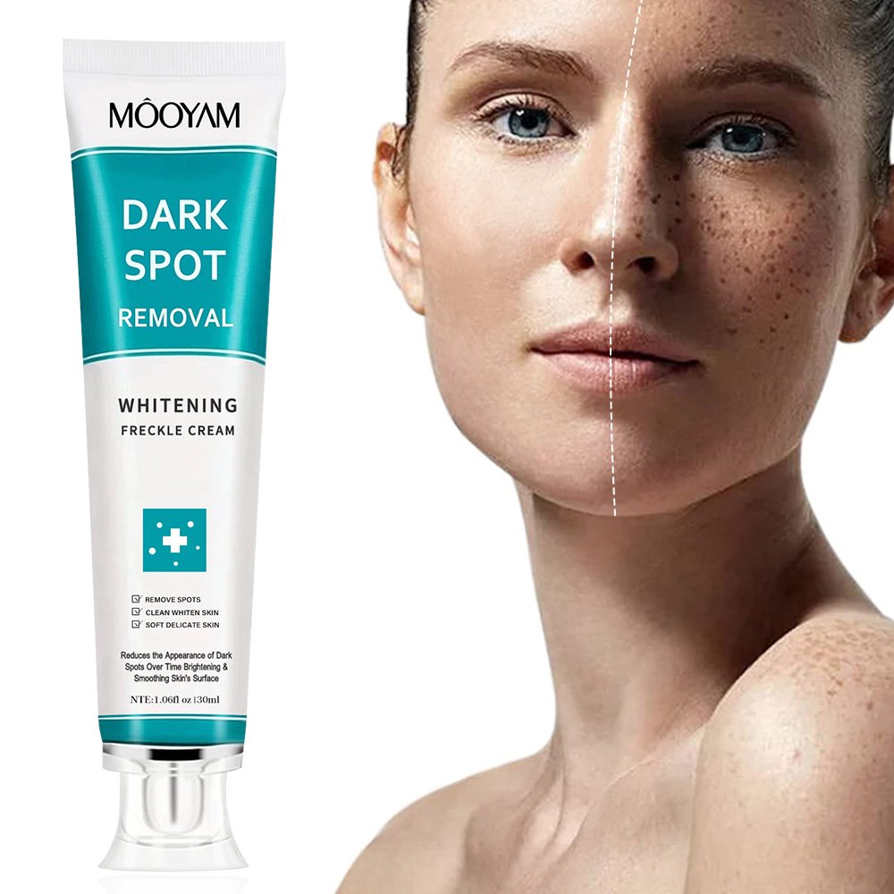Best sale MOOYAM face cream moisturizing dark spot cream lighting WHITENING FRECKLE CREAM 30g