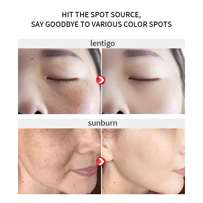 Skin 7 Days Brightening Face Cream Customized Skin Care Lightening Cream Female Night Moisturizing Lightening Cream