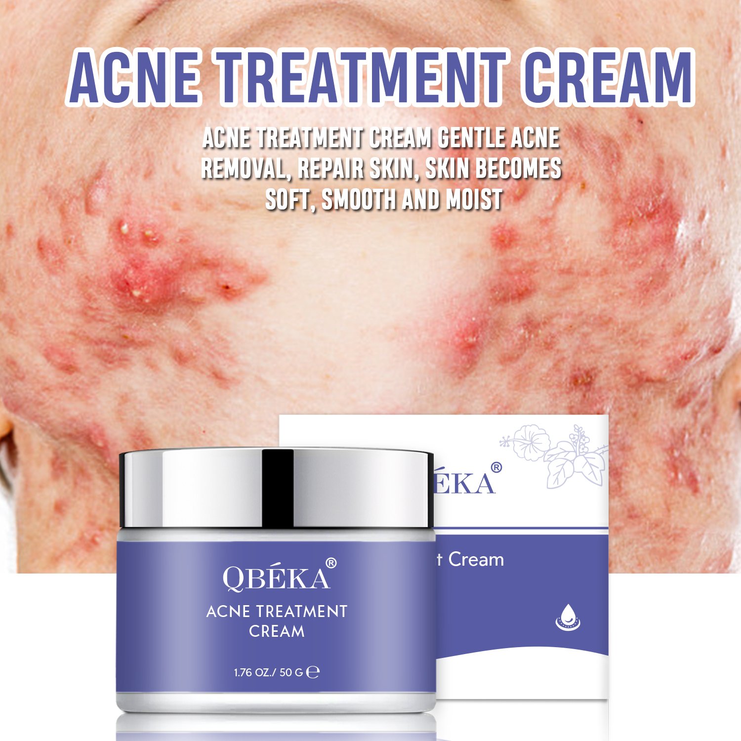 Wholesale Natural Organic Acne Treatment Cream, Removal Acne Treatment Face Cream, Repair Acne Scar Pimples