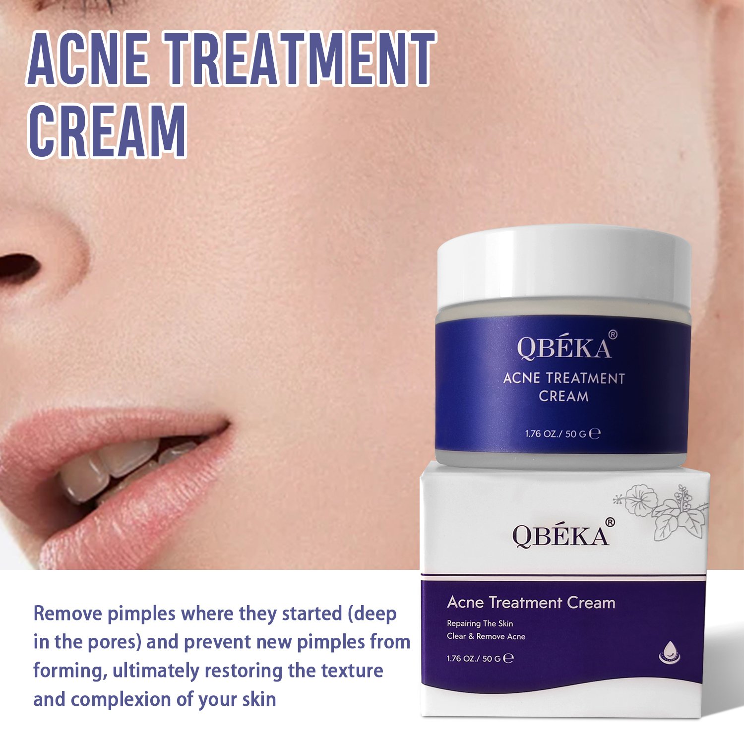 Wholesale Natural Organic Acne Treatment Cream, Removal Acne Treatment Face Cream, Repair Acne Scar Pimples