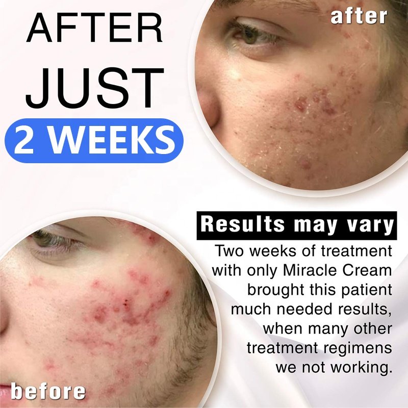 Private Label OEM Face Cream With Urea For Dry Skin Urea 40% Cream Moisturizer Whitening Vitamin E Lotion For Black Skin