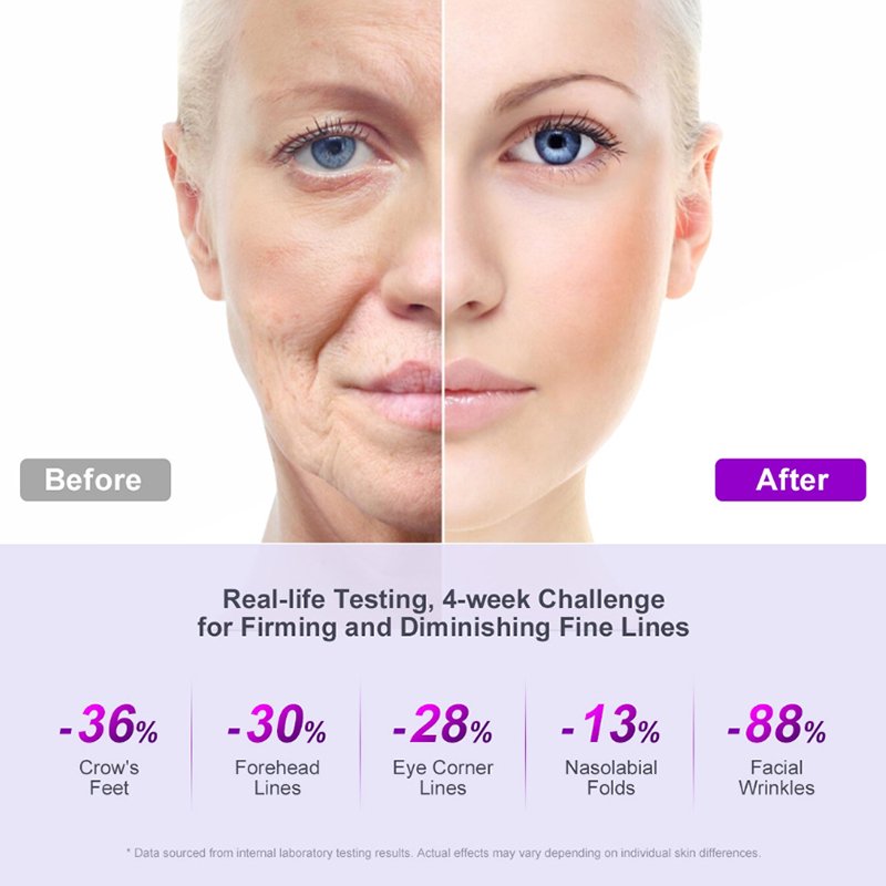 1kg Bakuchiol Cream Anti Wrinkle Reduce Face Lines Anti Aging Lightening Skin Psoralea Corylifolia Cream Remove Wrinkle
