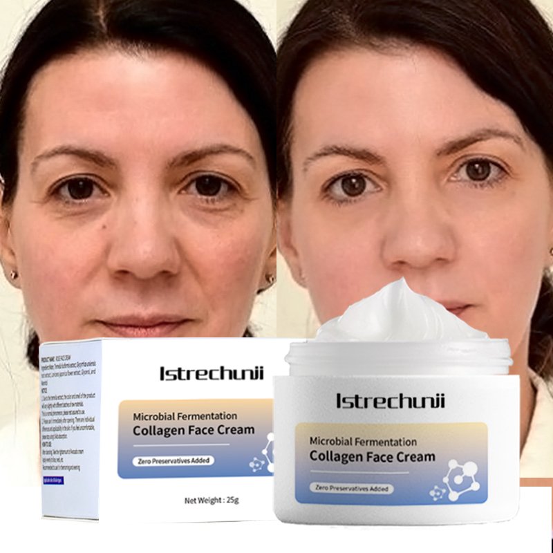 Microbial Fermentation Skincare Beauty Products Firming Cream Beauty Anti-Aging Relief Rough Skin Collagen Repair Face Creams