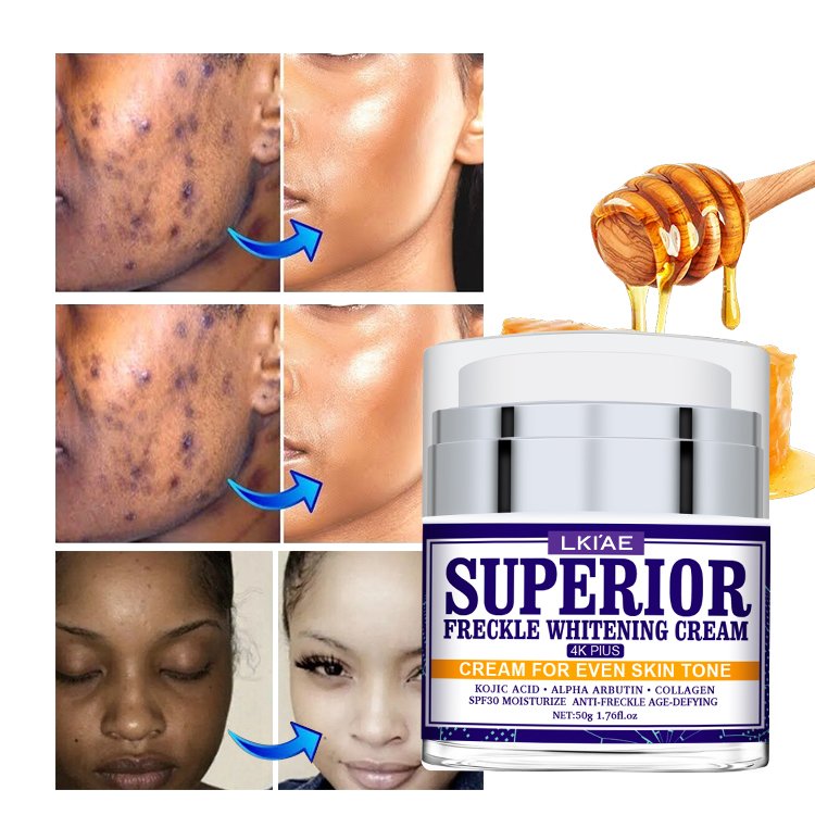 Excellent Extract Cosmetics Freckle Removing Facial Cream Lotion Natural All Purpose Anti-aging Skin Whitening Face Cream