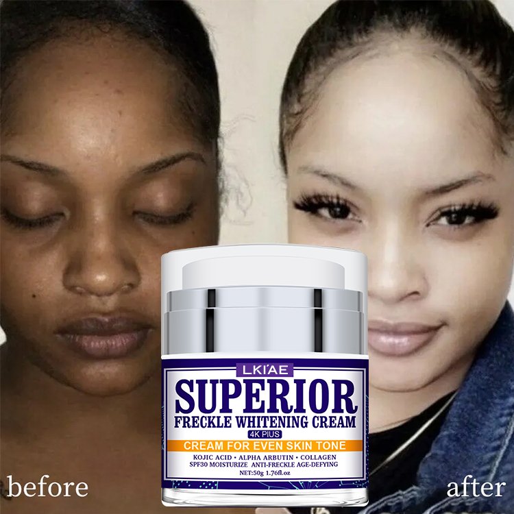 Excellent Extract Cosmetics Freckle Removing Facial Cream Lotion Natural All Purpose Anti-aging Skin Whitening Face Cream