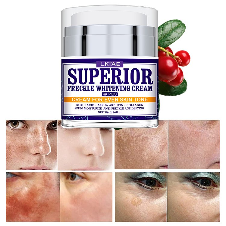 Excellent Extract Cosmetics Freckle Removing Facial Cream Lotion Natural All Purpose Anti-aging Skin Whitening Face Cream