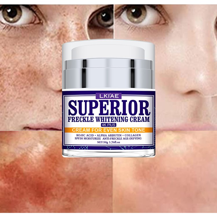 Excellent Extract Cosmetics Freckle Removing Facial Cream Lotion Natural All Purpose Anti-aging Skin Whitening Face Cream