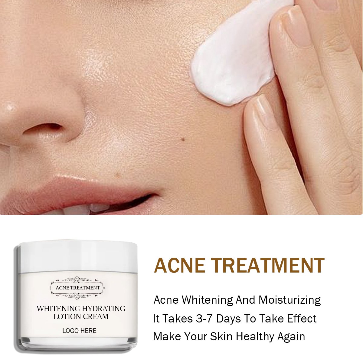 Acne treatment cream Acid Sun Bleaching Dark Spot Removing Skin Care Beauty Products Whitening Face Cream