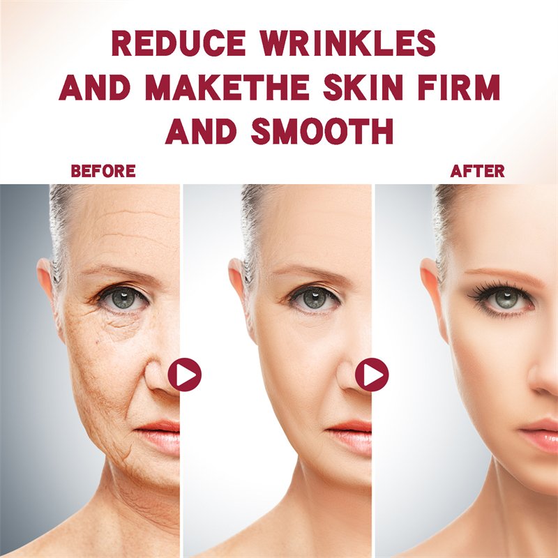 EELHOE fast effective peptides cream firming anti wrinkle retinol vitamin c collagen whitening face cream private label