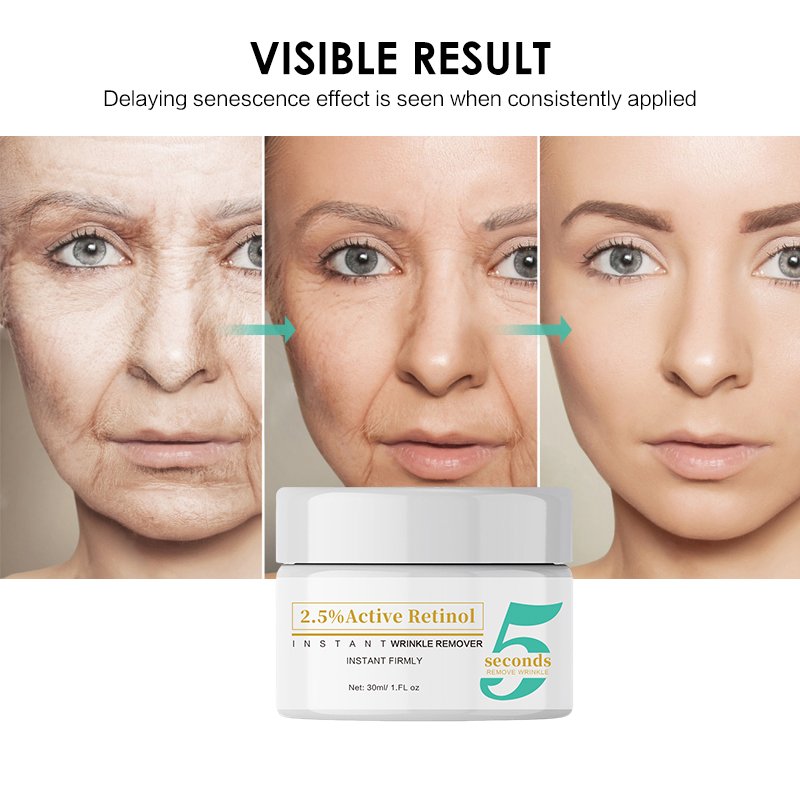 Wholesale Retinol Anti-Aging Instant Face Cream Lift Anti Wrinkles Moisturizer Facial Cream With Peptides Hyaluronic Acid
