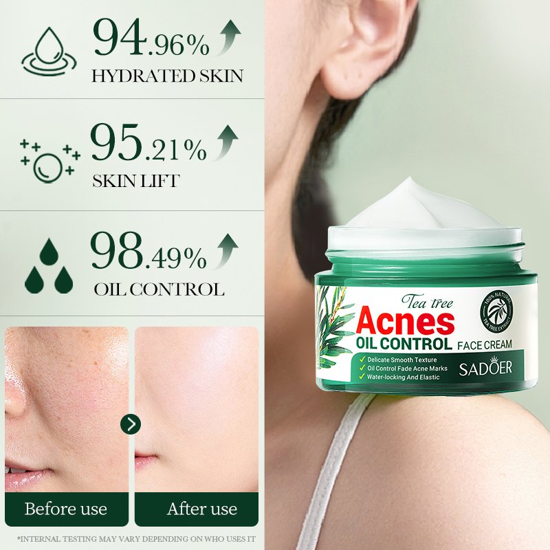 Tea Tree Face Cream Lotion Whitening Anti Acne Treatment Beauty Skin Care Moisturizing Nourishing Firming Facial Cream Day 5000
