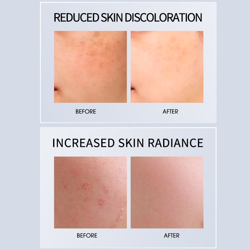 Wholesale Best Organic Moisturizer Dark Spot Removal Whitening Anti Wrinkles Aging Face Cream