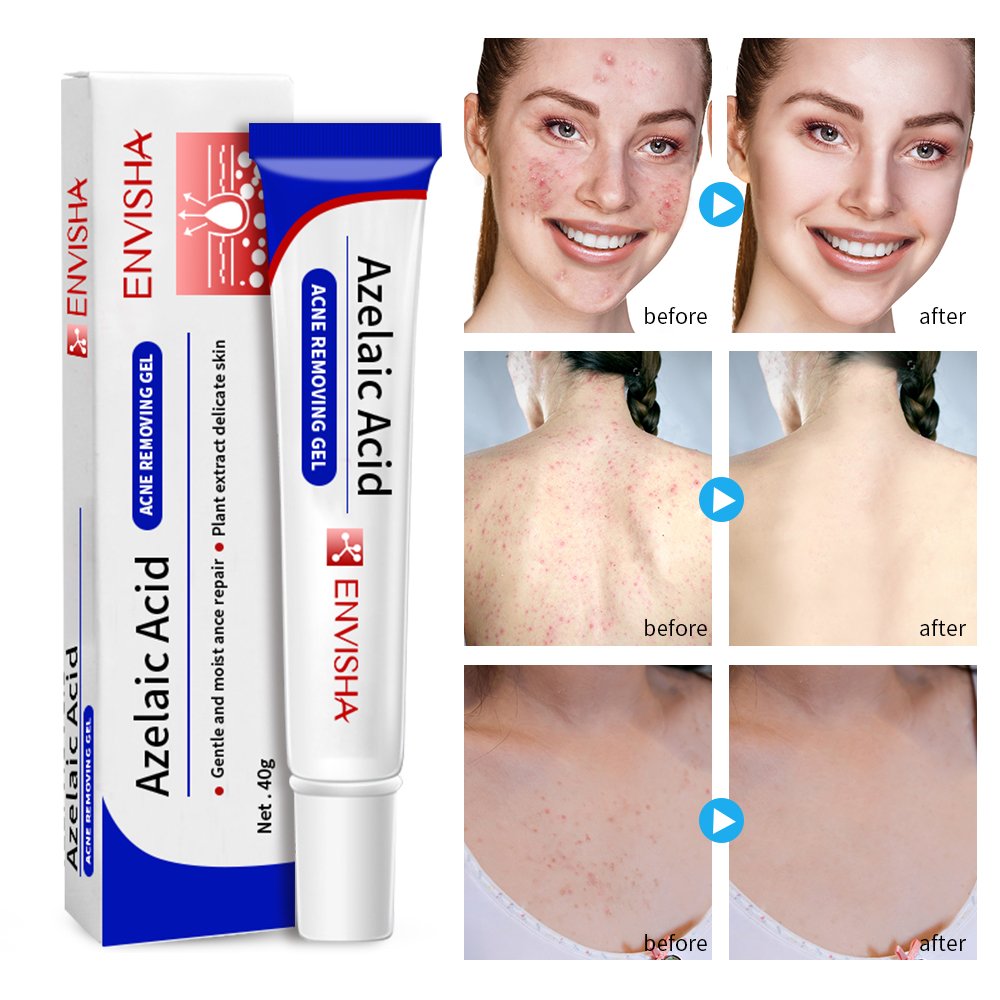 No Logo Scars Removal Face Cream Beauty Pure Skin Care Whitening Facial Moisturizing Cream Repairing Cream