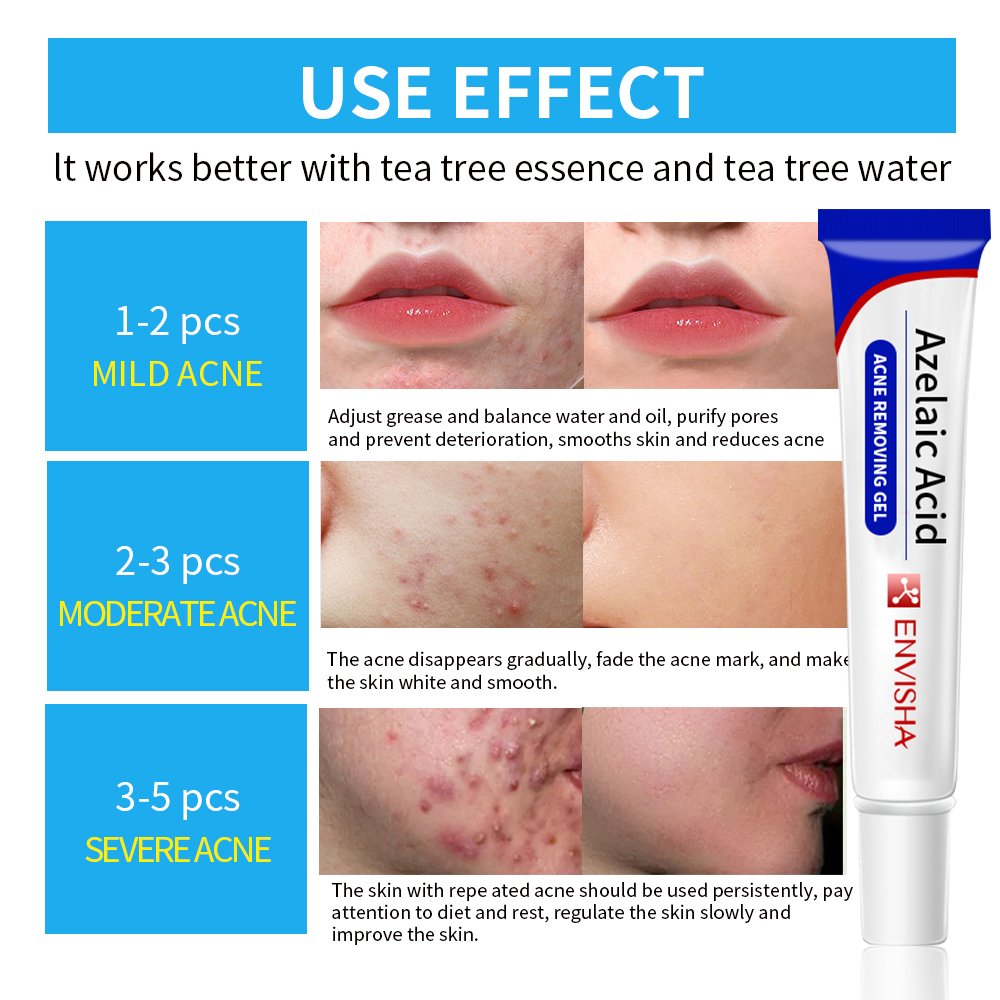 No Logo Scars Removal Face Cream Beauty Pure Skin Care Whitening Facial Moisturizing Cream Repairing Cream