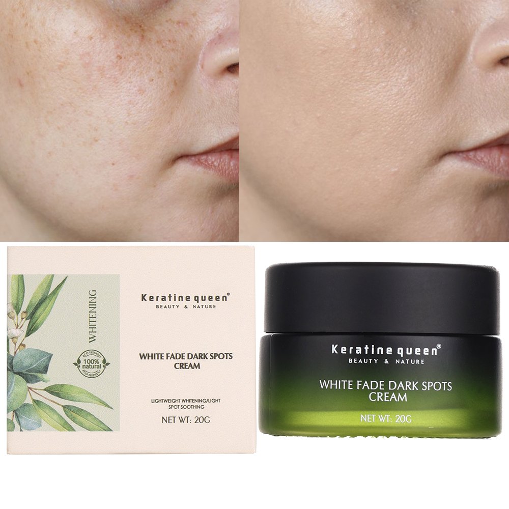 100% Natural Herbal Organic White Face Cream Facial Products Pimples Dark Spot Remover Cream