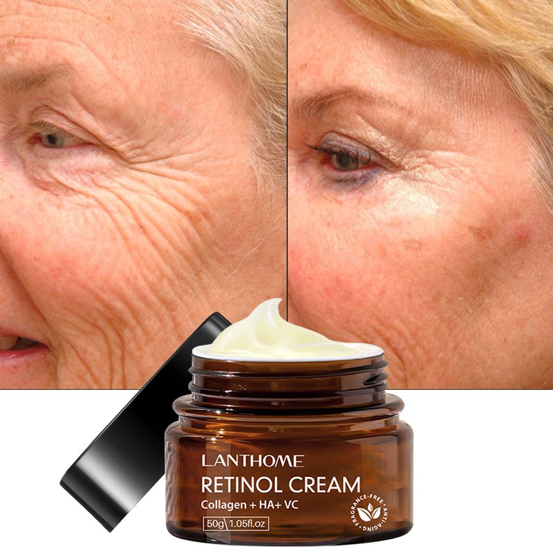 OEM Private Label Retinol Anti-Aging Facial Cream Remove Wrinkles Firming Lifting Whitening Moisturizer Day And Night Face Cream