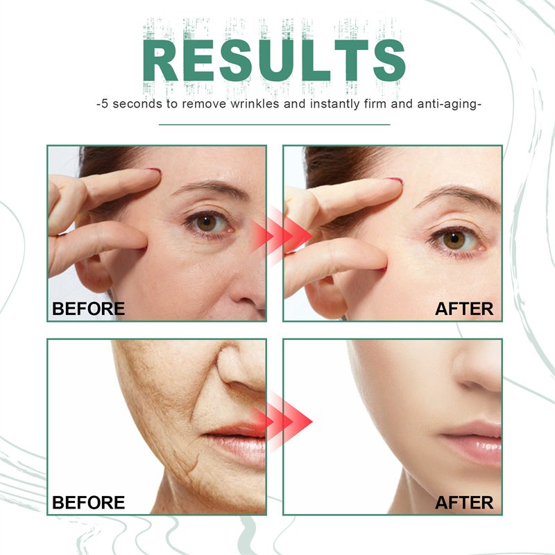 OUHOE instant wrinkle smooth retinol cream face anti aging remove wrinkles moisturizing cream dropshipping seconds wrinkle cream