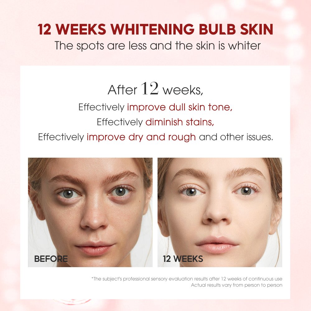 SKINEVER Organic Acerola Cherry Whitening Cream with Niacinamide Vitamin Collagen Glycerin Aqua Skin Care Set Face Cream
