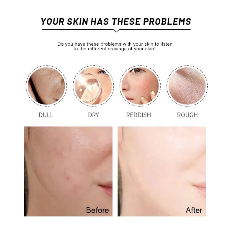 Private Label Hight Quality Anti Aging Vegan Collagen Whitening And Removing Freckles Ginseng Pearl Face Cream 1000g