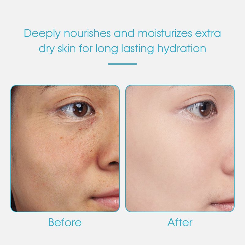 Korea-Night-Cream Sulfate-Free Pigmentation Correctors and Hyaluronic acid & Centella Whitening Skin Essence Face Cream